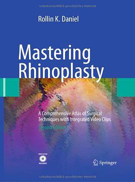 Mastering Rhinoplasty pdf epub mobi 电子书 下载