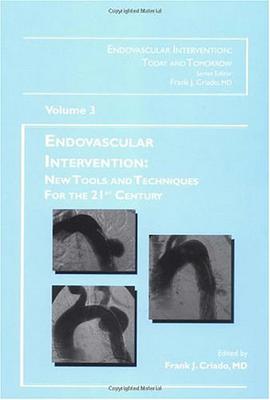 Endovascular Interventions