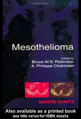 Mesothelioma pdf epub mobi 电子书 下载