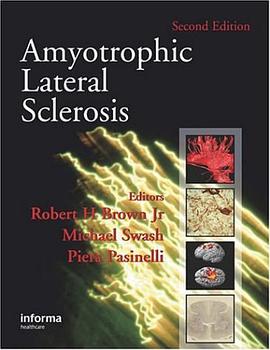 Amyotrophic Lateral Sclerosis pdf epub mobi 电子书 下载