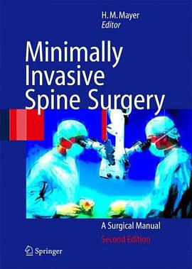 Minimally Invasive Spine Surgery pdf epub mobi 电子书 下载
