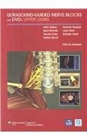Ultrasound-guided Nerve Blocks on DVD pdf epub mobi 电子书 下载