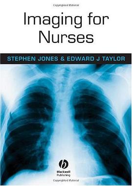 Imaging for Nurses pdf epub mobi 电子书 下载