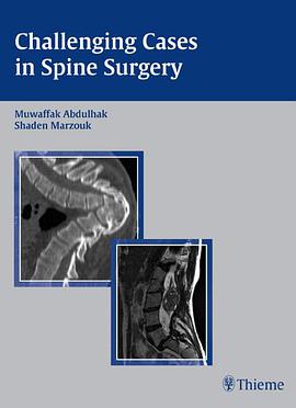 Challenging Cases in Spine Surgery pdf epub mobi 电子书 下载