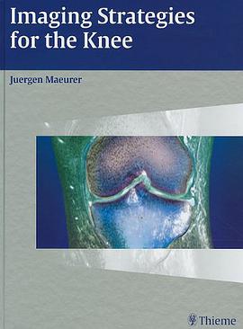 Imaging Strategies for the Knee pdf epub mobi 电子书 下载