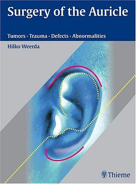 Surgery of the Auricle pdf epub mobi 电子书 下载