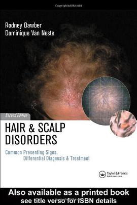 Hair and Scalp Disorders pdf epub mobi 电子书 下载