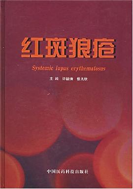 紅斑狼瘡 pdf epub mobi 電子書 下載
