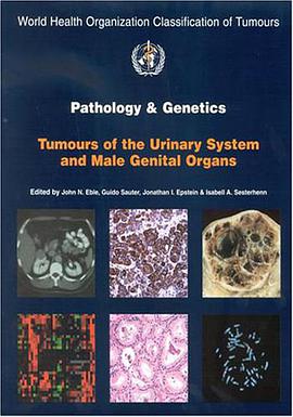 Pathology and Genetics of Tumours of the Urinary System and Male Genital Organs pdf epub mobi 电子书 下载