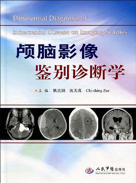 颅脑影像鉴别诊断学 pdf epub mobi 下载