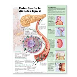 Understanding Type 2 Diabetes Anatomical Chart in Spanish pdf epub mobi 电子书 下载