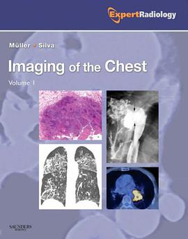 Imaging of the Chest, 2-Volume Set pdf epub mobi 电子书 下载