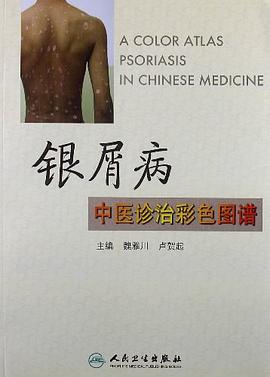 银屑病中医诊治彩色图谱 pdf epub mobi 电子书 下载