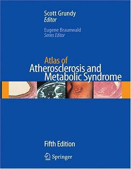 Atlas of Atherosclerosis and Metabolic Syndrome pdf epub mobi 电子书 下载