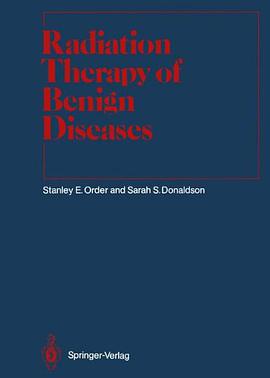 Radiation Therapy of Benign Diseases pdf epub mobi 电子书 下载