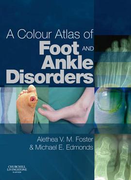 Colour Atlas of Foot and Ankle Disorders pdf epub mobi 电子书 下载