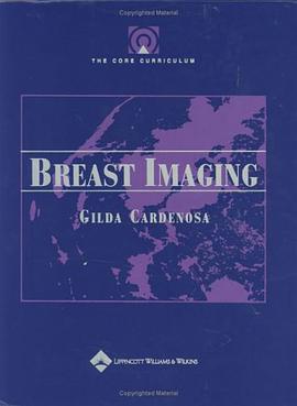 Breast Imaging pdf epub mobi 电子书 下载