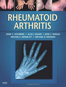 Rheumatoid Arthritis pdf epub mobi 电子书 下载