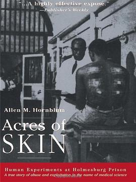 Acres of Skin pdf epub mobi 电子书 下载