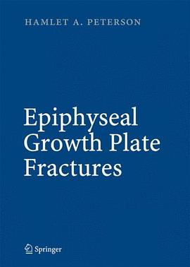 Epiphyseal Growth Plate Fractures pdf epub mobi 电子书 下载