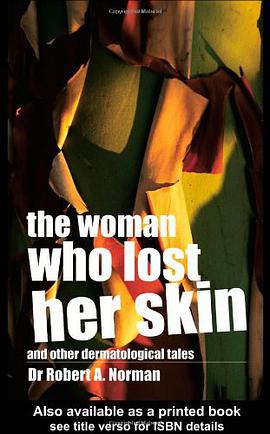 The Woman Who Lost Her Skin pdf epub mobi 电子书 下载