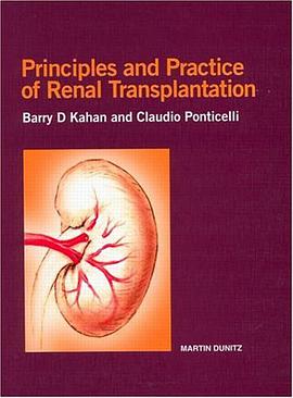 Principles and Practice of Renal Transplantation pdf epub mobi 电子书 下载
