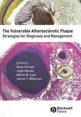 The Vulnerable Atherosclerotic Plaque - Strategiesfor Diagnosis And Managementreadings pdf epub mobi 电子书 下载