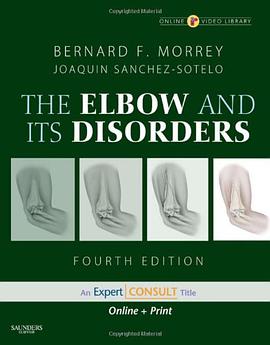 The Elbow and Its Disorders pdf epub mobi 下载