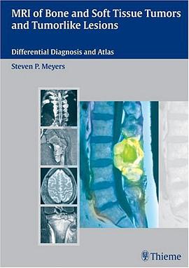 MRI of Bone and Soft Tissue Tumors and Tumorlike Lesions pdf epub mobi 电子书 下载