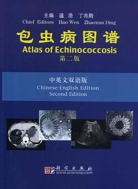 包虫病图谱（中英文） pdf epub mobi 电子书 下载