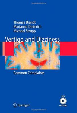 Vertigo and Dizziness pdf epub mobi 电子书 下载