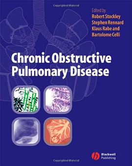 Chronic Obstructive Pulmonary Disease pdf epub mobi 电子书 下载