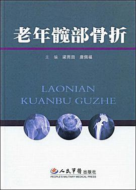 老年髋部骨折 pdf epub mobi 电子书 下载