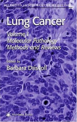 Lung Cancer pdf epub mobi 电子书 下载