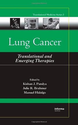 Lung Cancer pdf epub mobi 电子书 下载