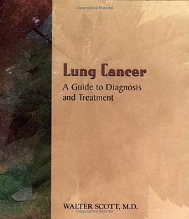 Lung Cancer pdf epub mobi 电子书 下载