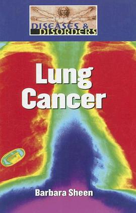 Lung Cancer pdf epub mobi 下载