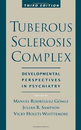 Tuberous Sclerosis Complex pdf epub mobi 电子书 下载