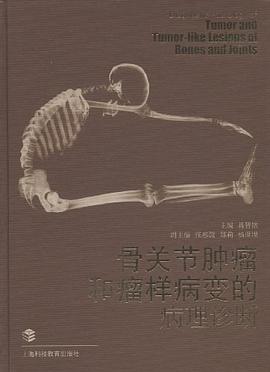骨关节肿瘤和瘤样病变的病理诊断 pdf epub mobi 电子书 下载