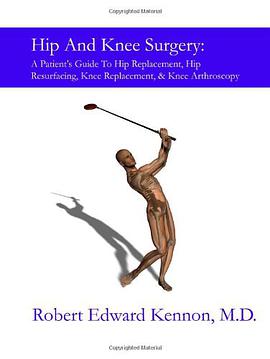 Hip And Knee Surgery pdf epub mobi 电子书 下载