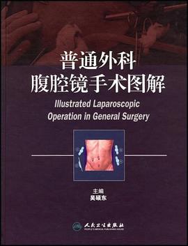 普通外科腹腔镜手术图解 pdf epub mobi 电子书 下载