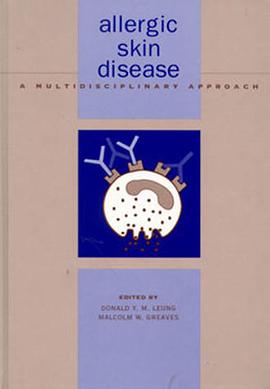 Allergic Skin Disease pdf epub mobi 电子书 下载