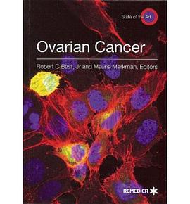 Ovarian Cancer pdf epub mobi 电子书 下载