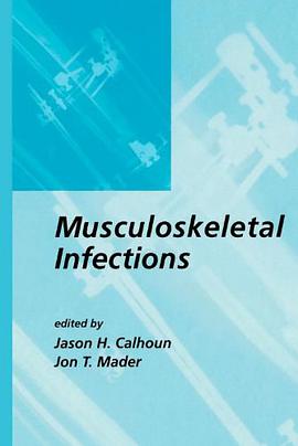 Musculoskeletal Infections pdf epub mobi 电子书 下载
