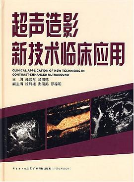 超聲造影新技術臨床應用 pdf epub mobi 電子書 下載