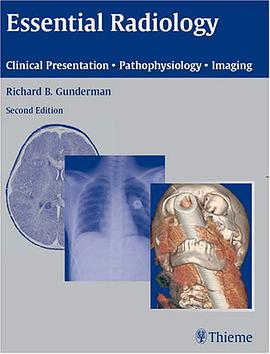 Essential Radiology pdf epub mobi 电子书 下载