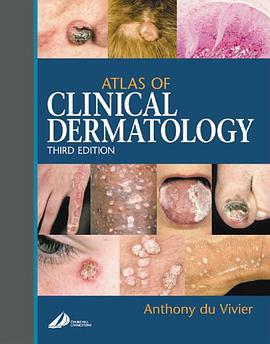 Atlas of Clinical Dermatology pdf epub mobi 电子书 下载