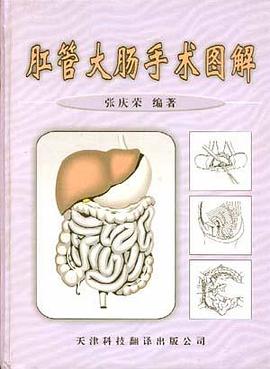 肛管大肠手术图解 pdf epub mobi 电子书 下载