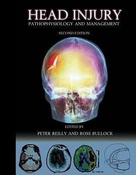 Head Injury pdf epub mobi 电子书 下载
