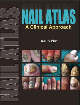 Nail Atlas pdf epub mobi 電子書 下載